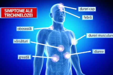 TRICHINELOZA POATE FI MORTALĂ